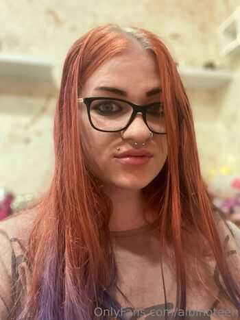 albinoteen