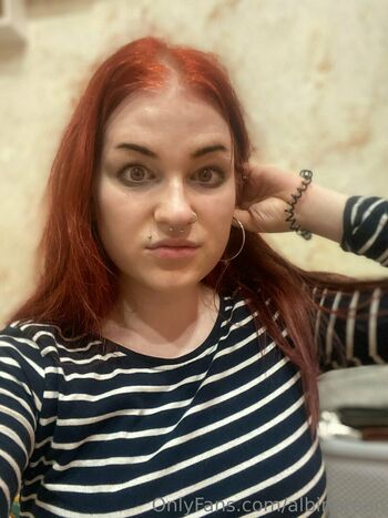 albinoteen