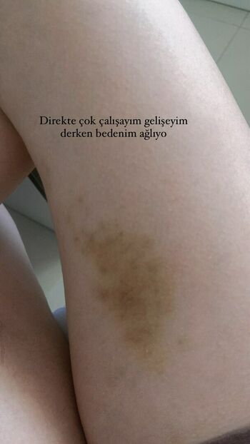 Aldreann