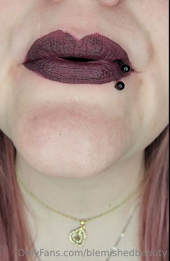 blemishedbeauty