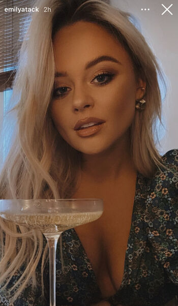 Emily Atack