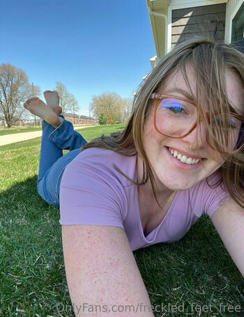 freckled_feet_free