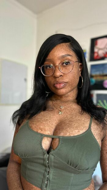 freckledn