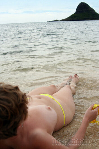 Freckles