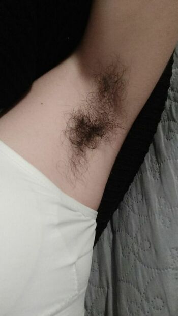 Hairy Women