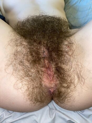 Hairy Women