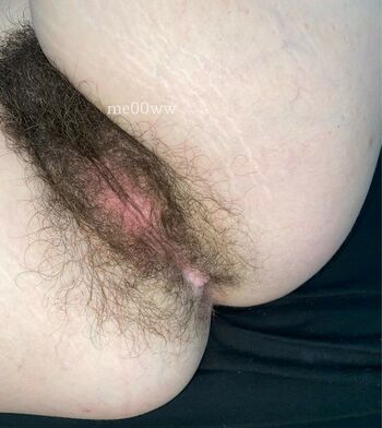 Hairy Women
