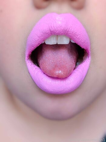 LovelyWatermelon1