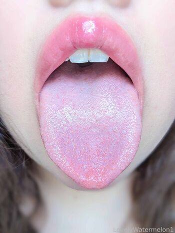 LovelyWatermelon1
