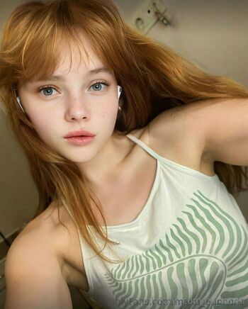 mi_ameli