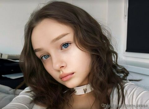 mi_ameli