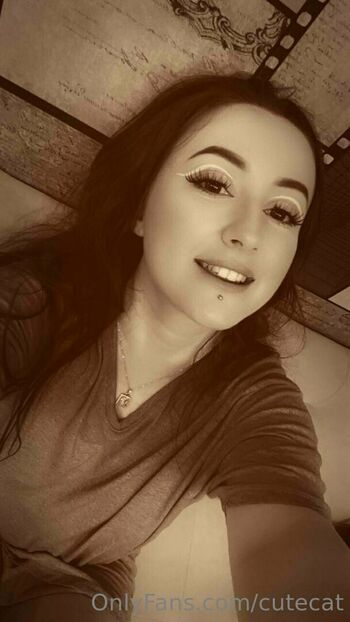 mi_ameli