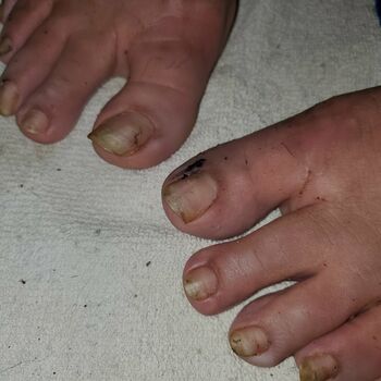 missfeetstink