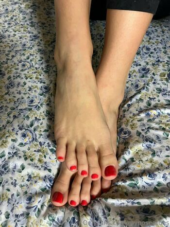 myposedtoes