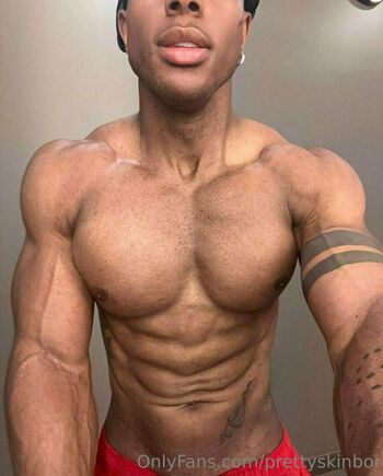 prettyskinboi