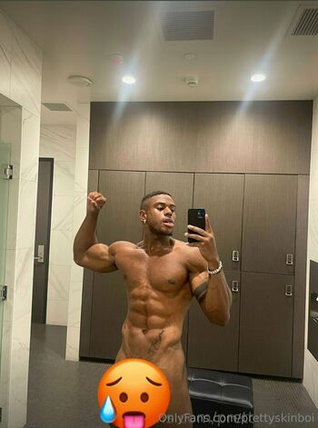 prettyskinboi