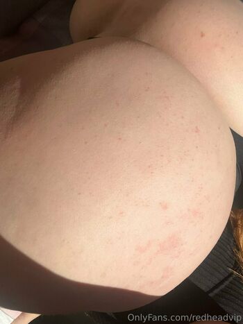 redheadvip