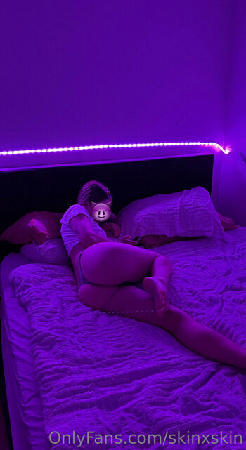 skinxskin