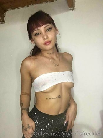 sofisfreckles