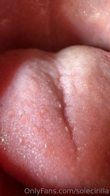 solecirilla