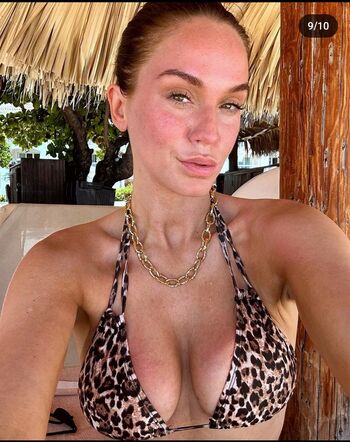 Vicky Pattison