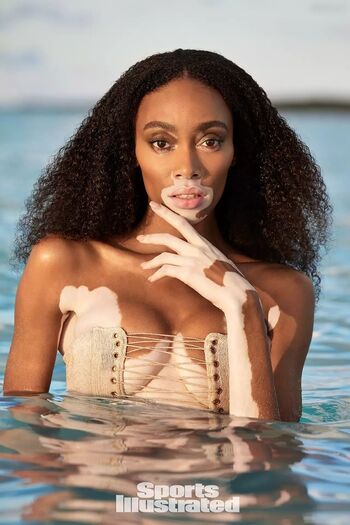 Winnie Harlow