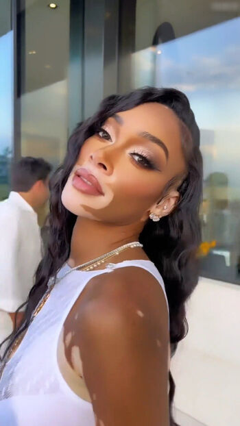 Winnie Harlow