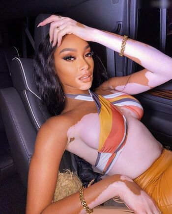 Winnie Harlow