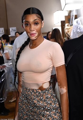 Winnie Harlow