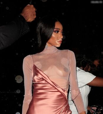 Winnie Harlow
