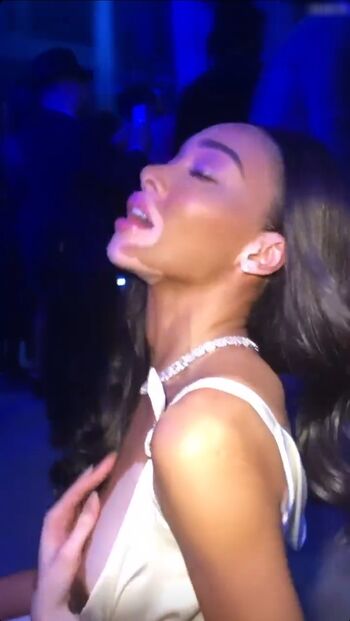 Winnie Harlow
