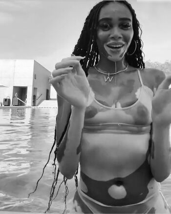 Winnie Harlow