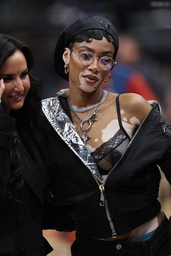 Winnie Harlow