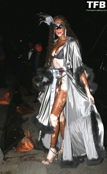 Winnie Harlow
