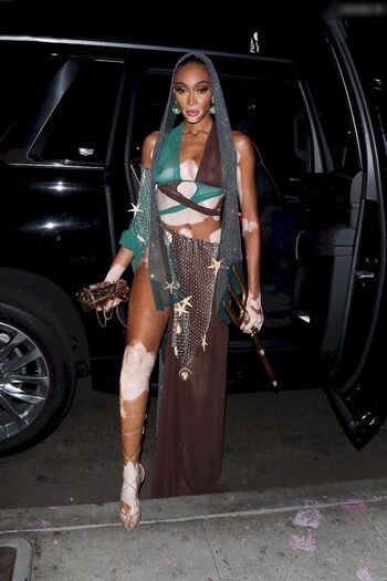 Winnie Harlow