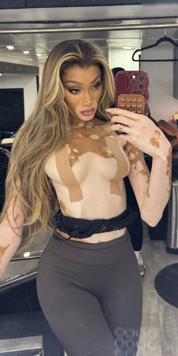 Winnie Harlow