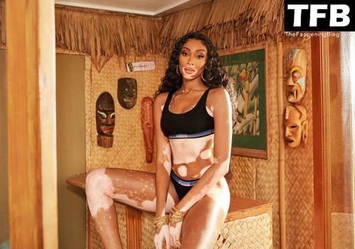 Winnie Harlow
