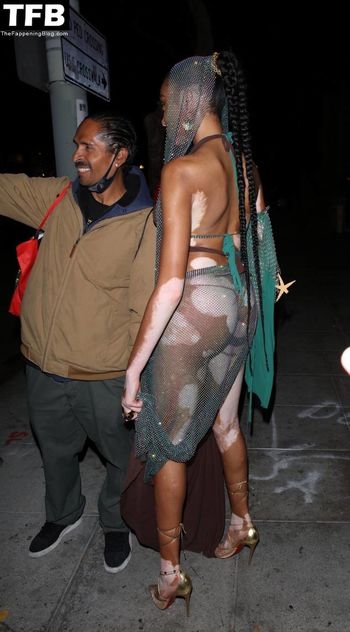 Winnie Harlow