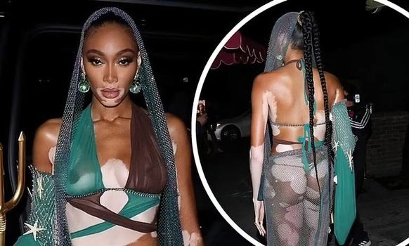 Winnie Harlow