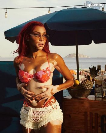 Winnie Harlow