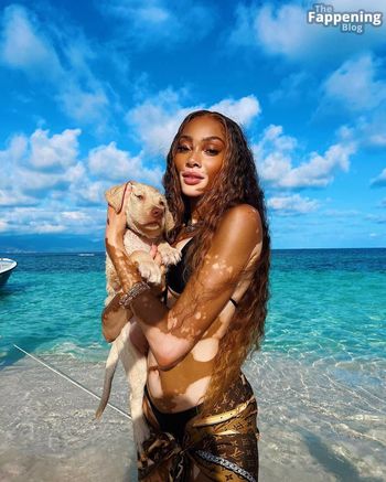 Winnie Harlow