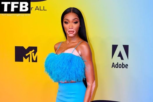 Winnie Harlow