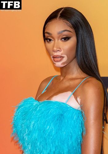 Winnie Harlow