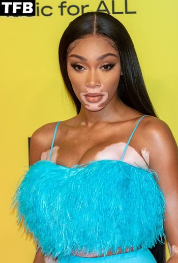 Winnie Harlow