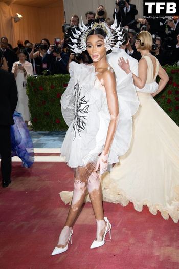 Winnie Harlow