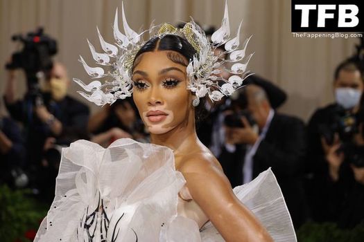 Winnie Harlow