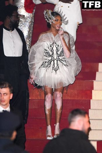 Winnie Harlow