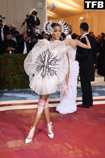 Winnie Harlow