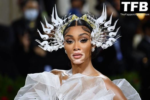Winnie Harlow