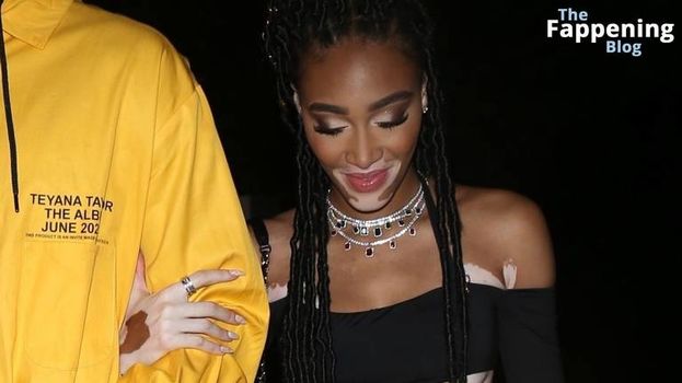 Winnie Harlow